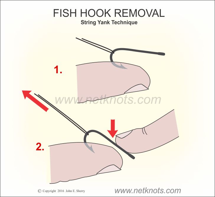 Hook Removal - String Yank