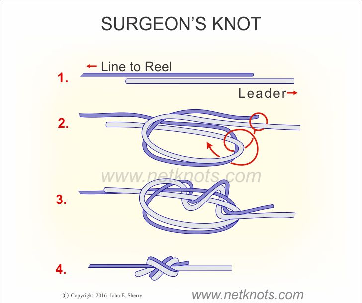 Surgeons Knot - How to tie a Surgeon's Knot